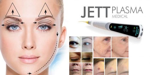 Rejuvenecimiento con plasma láser