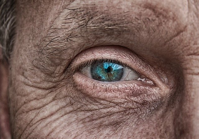 Entérate cómo actúa el Ultraformer en la piel persona mayor que necesita el Ultraformer