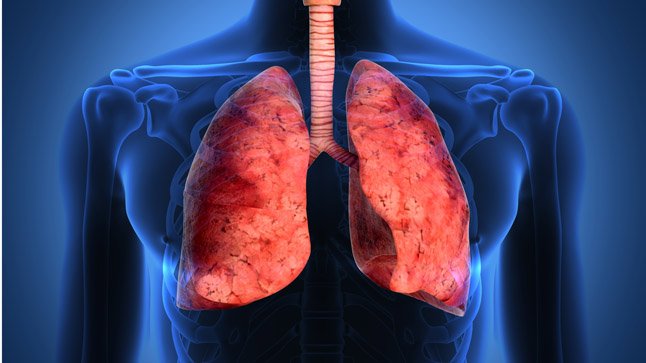 Síntomas de fibrosis pulmonar: Aprende a identificarlos