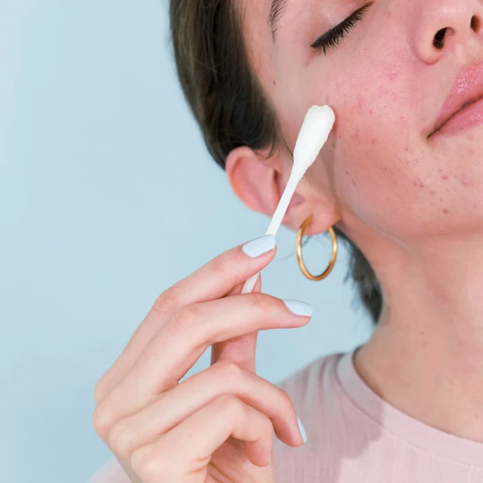 ¿Qué hacer y qué no hacer ante un brote de granitos? granitos de la cara